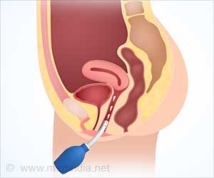 Vaginal Douching - Is It Really Beneficial?