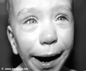 Weaver Syndrome / Weaver-Smith Syndrome