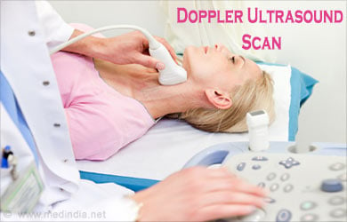 Doppler ultrasound: Uses, what to expect, and results