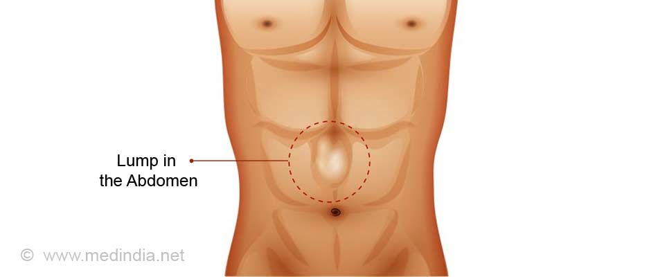 lower left abdominal pain in men