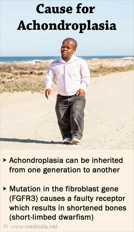 achondroplastic dwarfism