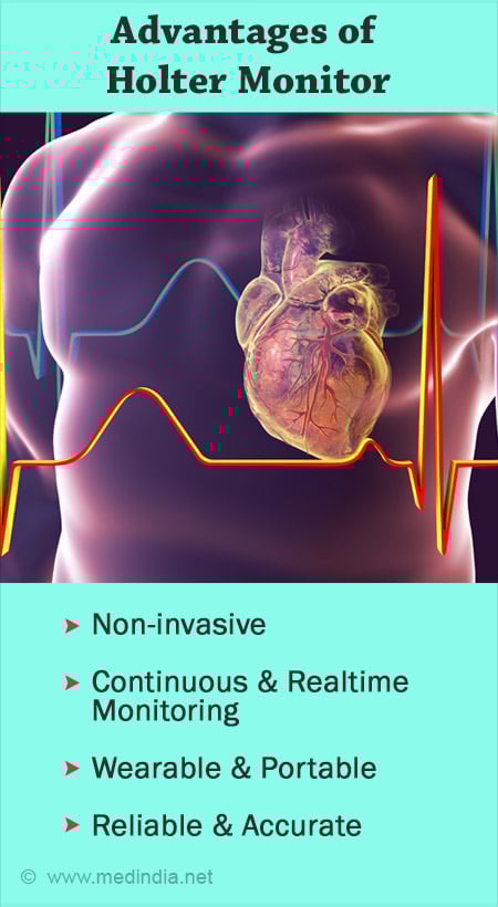 Holter ECG at Home in Bangalore