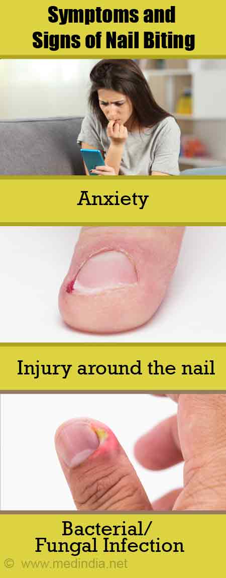 Symptoms and Signs of Nail Biting