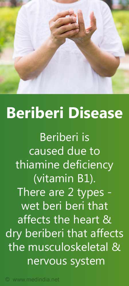 Beriberi Disease Causes Risk Factors Symptoms Diagnosis 46 Off