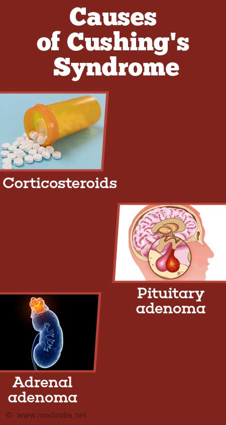 Cushing S Syndrome Causes Symptoms Diagnosis And Management