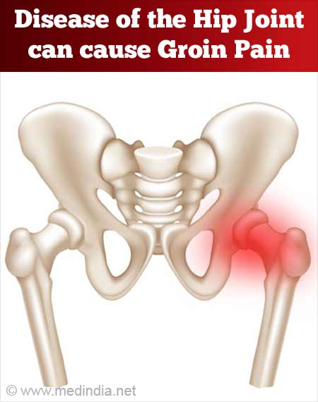 Pain in Groin – Causes and Treatment