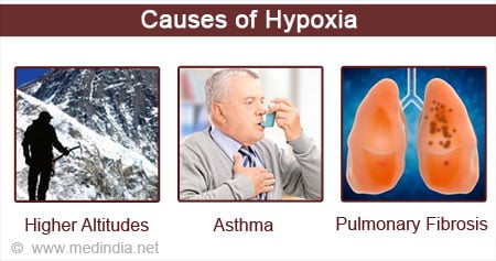 Hypoxia Causes Symptoms Tests Diagnosis Treatment - vrogue.co