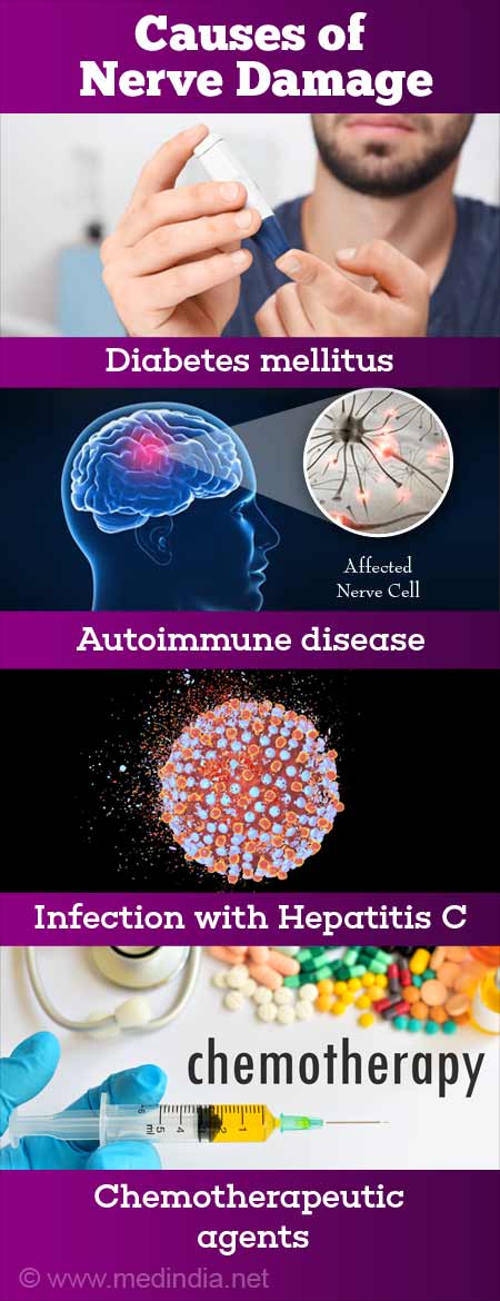 sensory nerve damage