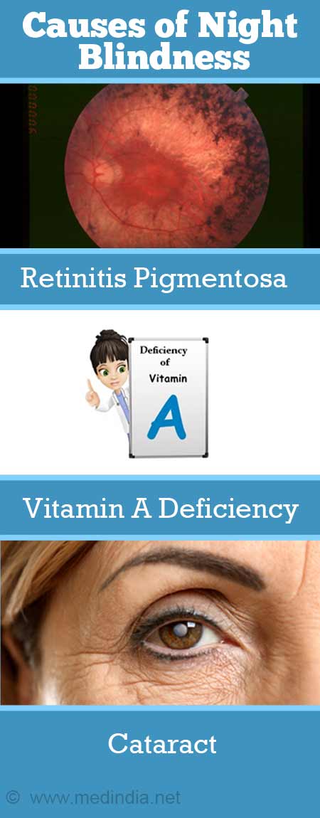 Night Blindness Caused By Isotretinoin