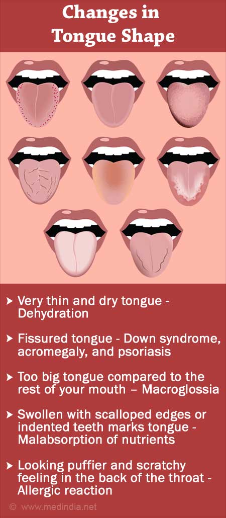 Learn What Tongue Your General Health