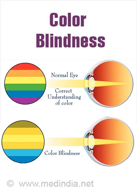 Color Blindness