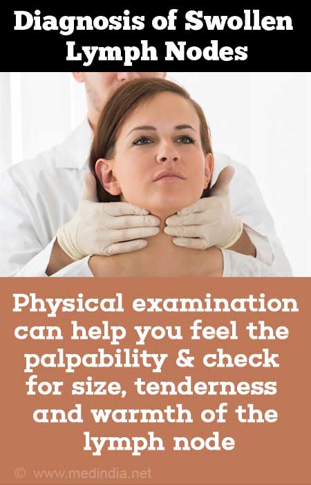 Nodes swollen lymph remedies for Are Swollen