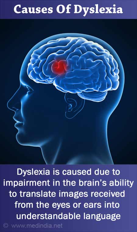dyslexia research paper topics