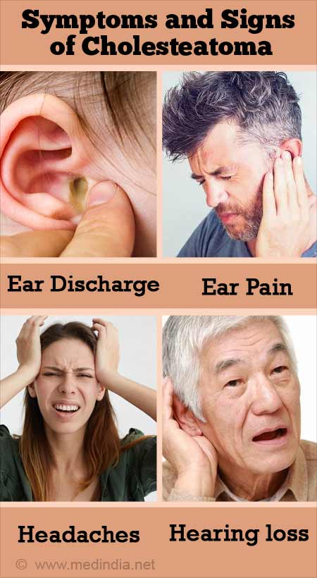 Symptoms and Signs of Cholesteatoma