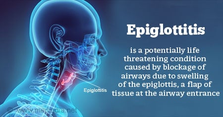 Swollen Epiglottis Treatment