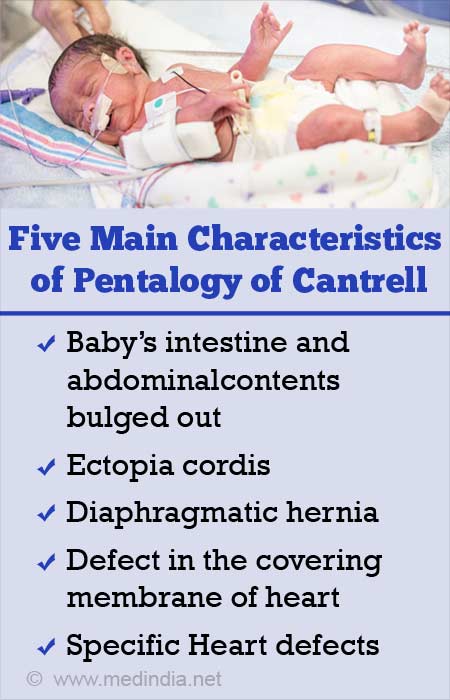 Pentalogy of Cantrell