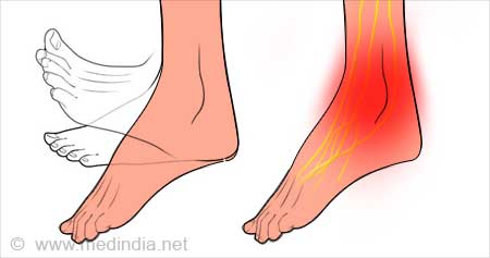 All About Drop Foot - Symptoms, Causes, & Treatments