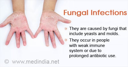 human fungal infections