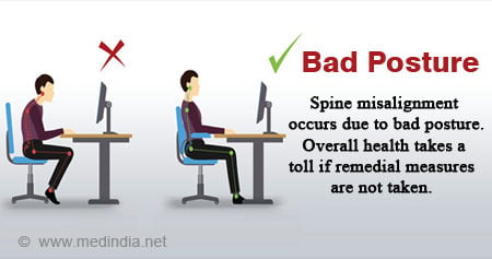 Analyzing Bad Posture and The Increased Likelihood of Falls in