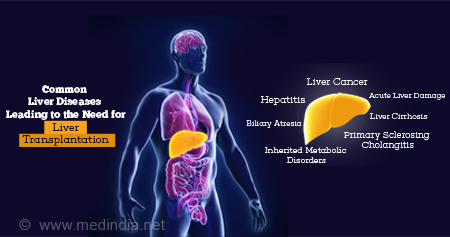 Common Types of Liver diseases leading to Liver Transplantation