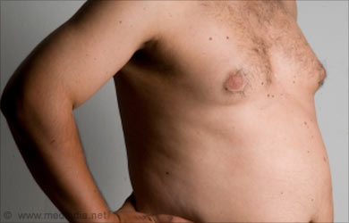 Male breast cancer