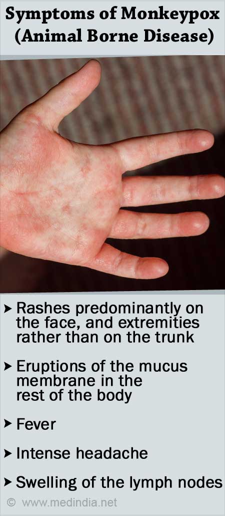 Mpox (Monkeypox): Causes, Symptoms, Treatment & Prevention