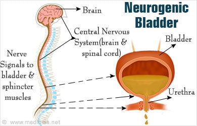 Neurogenic Bladder Tests and Diagnosis