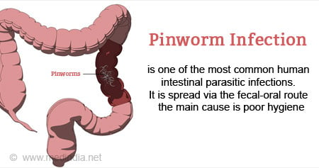 Pinworm  Thread worm Infection - Causes, Symptoms, Diagnosis, Treatment &  Prevention - Frequently Asked Questions