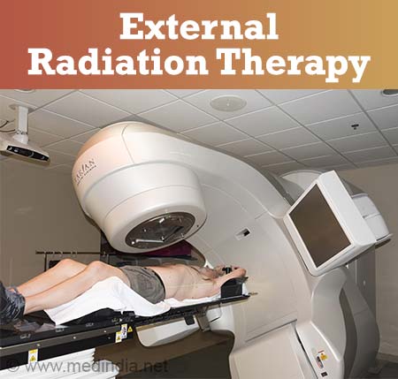 Types of Radiation Therapies for Prostate Cancer 