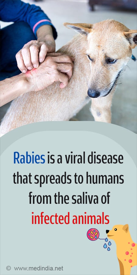 Rabies - Types, Causes, Symptoms, Diagnosis, Treatment & Prevention