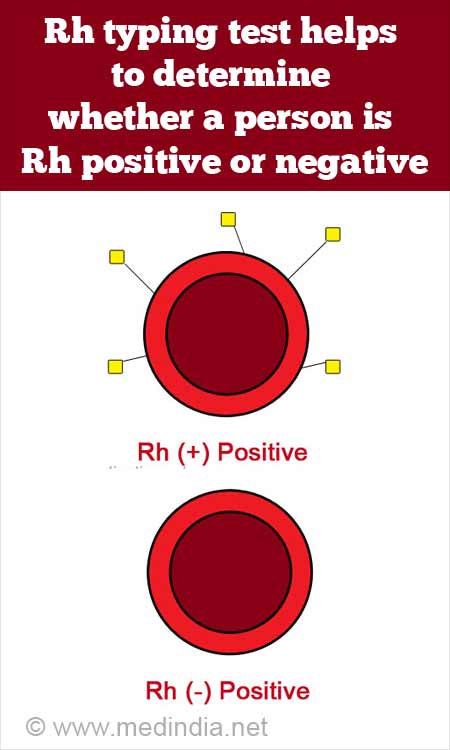 rh factor blood type
