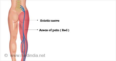 https://images.medindia.net/patientinfo/450_237/sciatica-exercises.jpg