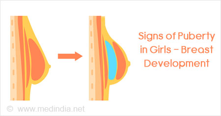 Girlology - Definitely. Uneven breast growth is normal. Most breast  development begins on one side first, and might continue to be uneven  through puberty. Most of the time the difference is not