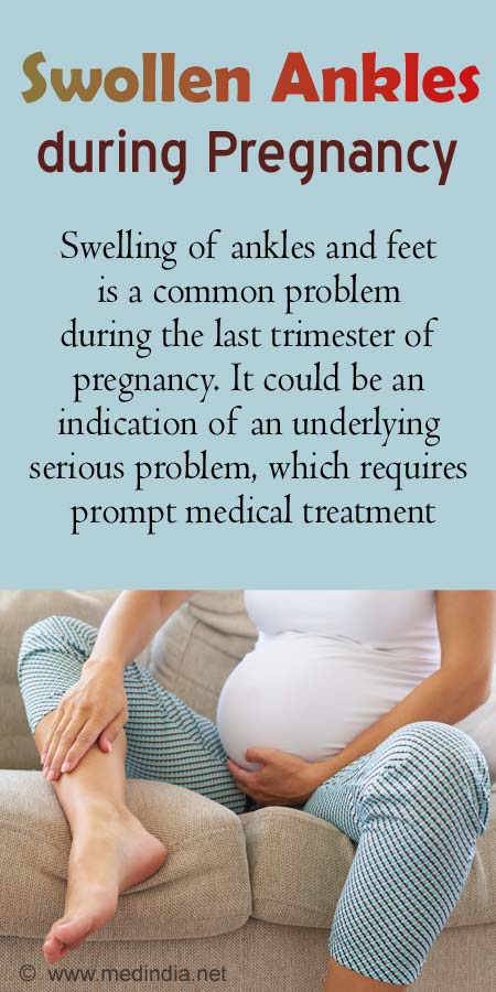 Swollen Ankles during Pregnancy - Causes Symptoms Prevention Treatment