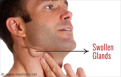 Can you have swollen lymph nodes in the groin area from shingles