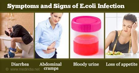 E Coli Infection Escherichia Coli Infection Causes Diagnosis Symptoms Treatment Risk Factors Prevention