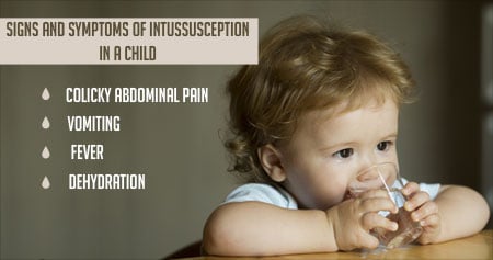 intussusception in children
