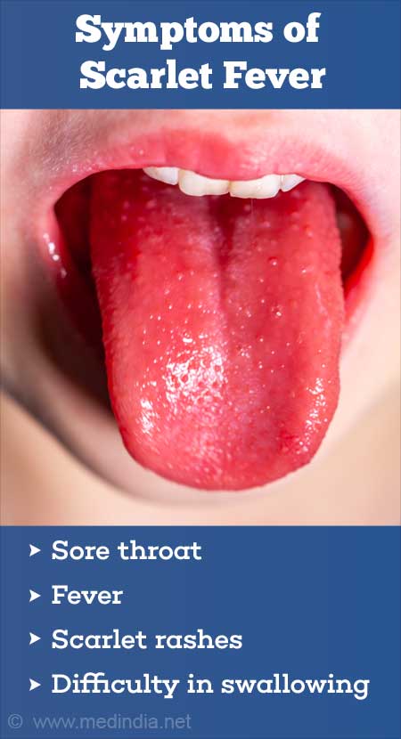 Scarlet Fever: What it Looks Like and What Causes it