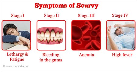 Scurvy: Symptoms, Causes Treatment, 60% OFF