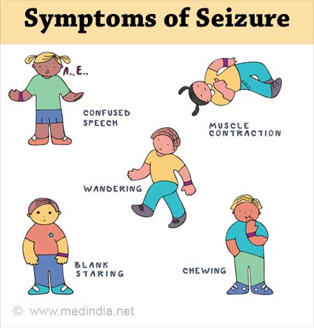 Common Symptoms Of Epileptic Seizures LivLong