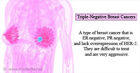 Breast Cancer Now - 'I was diagnosed with triple negative breast
