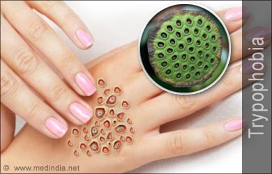 Trypophobia  Fear of Too Many Holes: Causes Symptoms Diagnosis