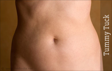 What Is A Tummy Tuck (Abdominoplasty)?
