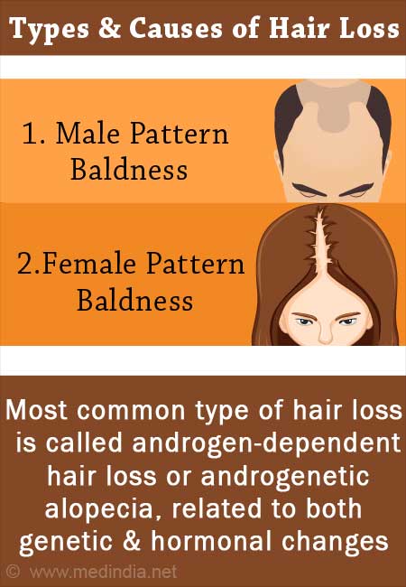 Can Psoriasis Cause Hair Loss? | RHRLI