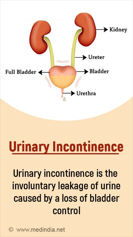 Stress urinary incontinence: MedlinePlus Medical Encyclopedia