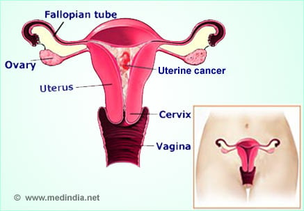 Know your body, know the symptoms of uterine cancer - VA News