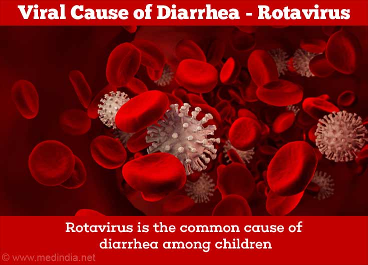 viral diarrhea