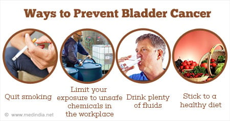 How can you prevent getting Bladder Cancer? - Urologist Ahmedabad