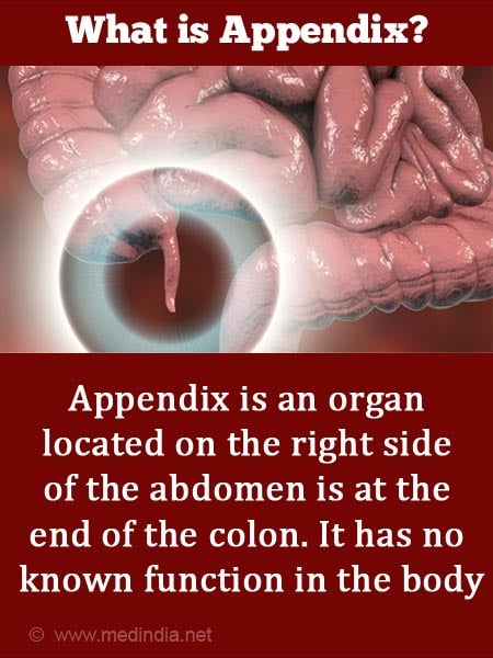 Appendicitis Information