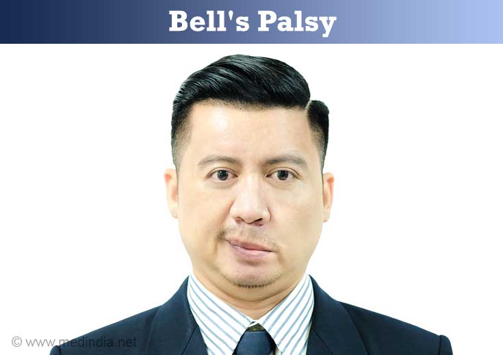 17 Bells Palsy ideas  bells palsy, types of facials, paralysis